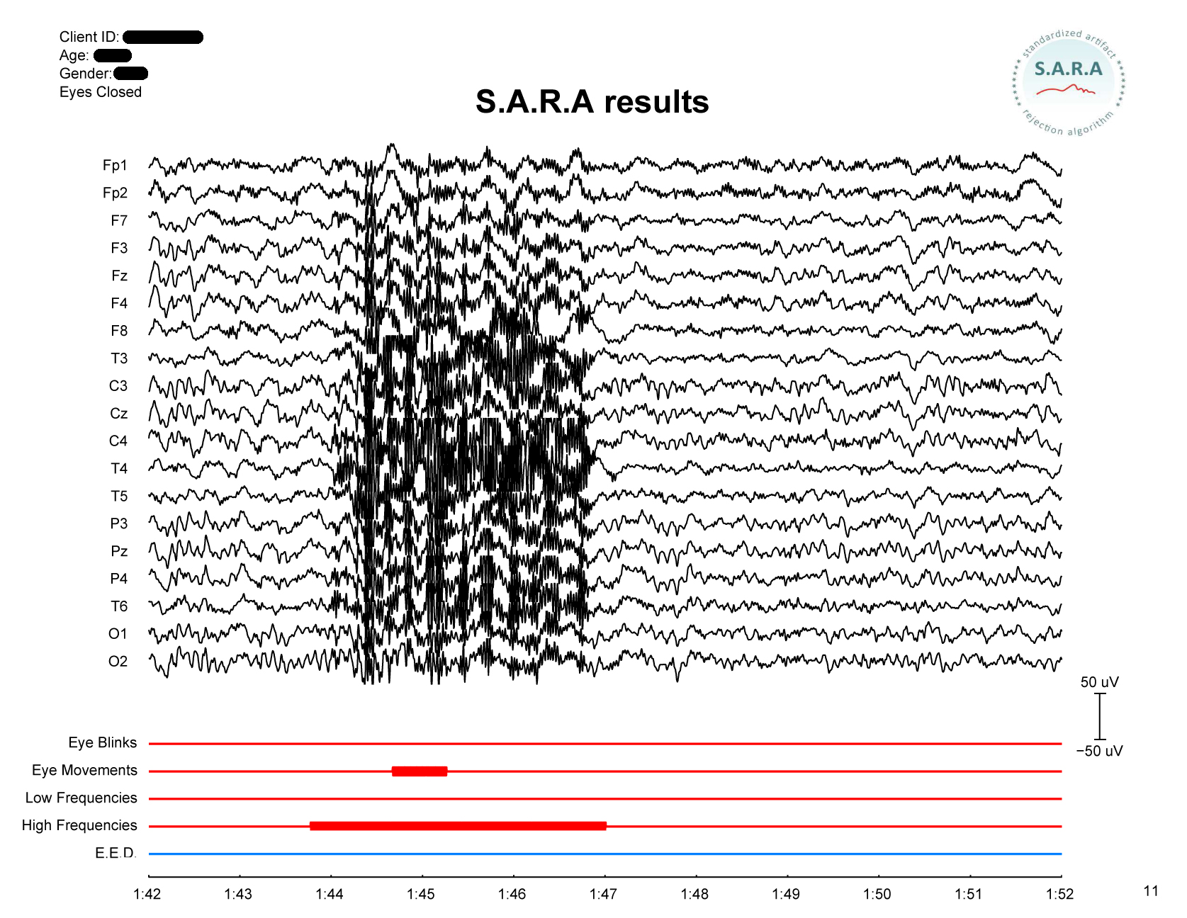 how-does-it-work-qeeg-pro